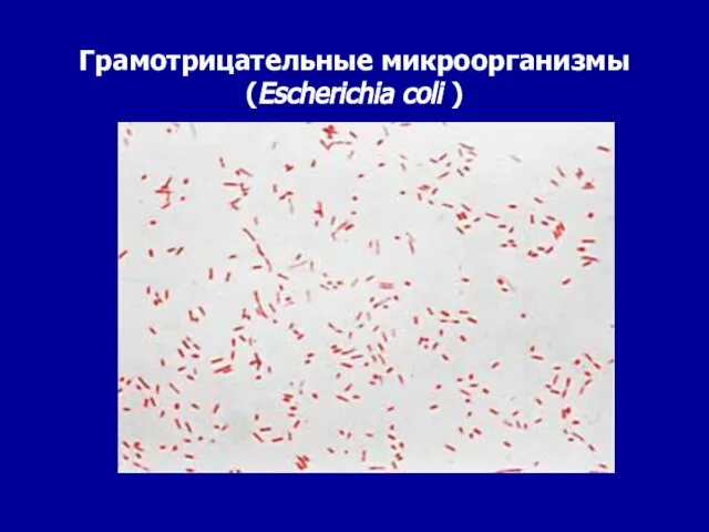 Грамотрицательные микроорганизмы (Escherichia coli )