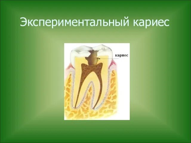 Экспериментальный кариес