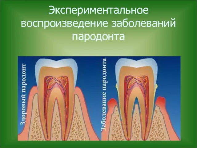 Экспериментальное воспроизведение заболеваний пародонта