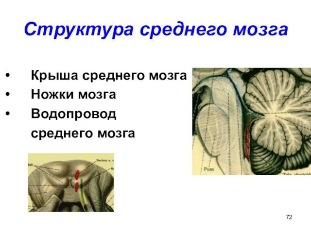 Структура среднего мозга Крыша среднего мозга Ножки мозга Водопровод среднего мозга