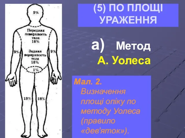 (5) ПО ПЛОЩІ УРАЖЕННЯ Мал. 2. Визначення площі опіку по методу Уолеса