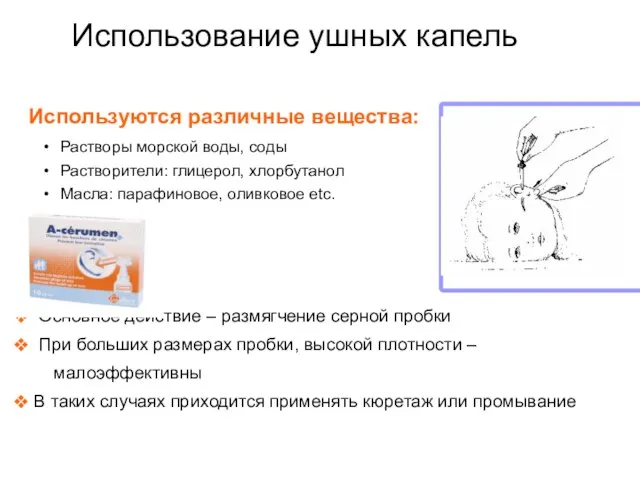 Использование ушных капель Используются различные вещества: Растворы морской воды, соды Растворители: глицерол,