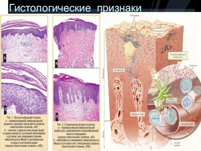 Гистологические признаки