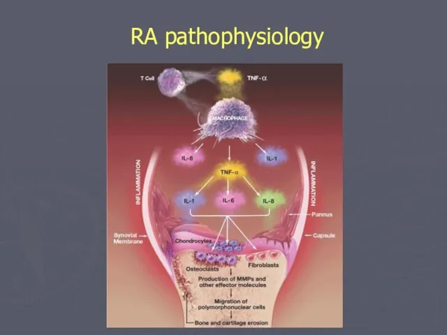 RA pathophysiology