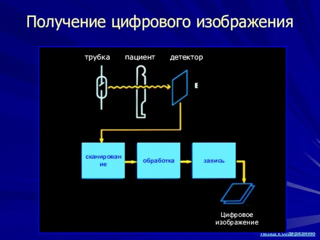 Получение цифрового изображения трубка пациент детектор сканирование обработка запись Цифровое изображение