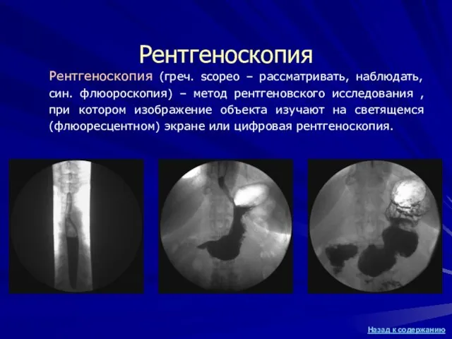 Рентгеноскопия Рентгеноскопия (греч. scopeo – рассматривать, наблюдать, син. флюороскопия) – метод рентгеновского