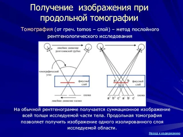 Получение изображения при продольной томографии На обычной рентгенограмме получается суммационное изображение всей