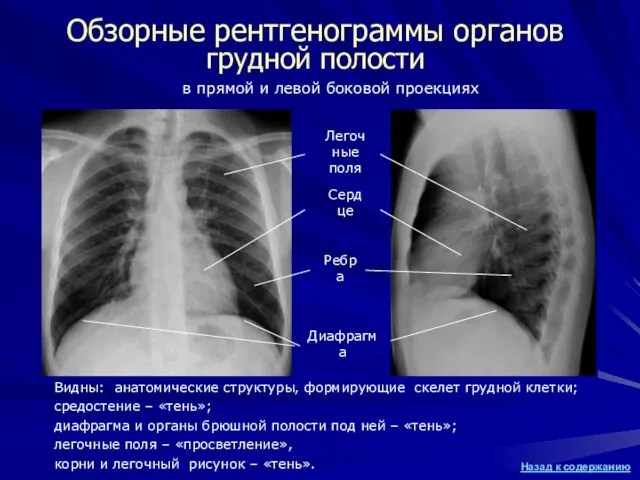 Обзорные рентгенограммы органов грудной полости Видны: анатомические структуры, формирующие скелет грудной клетки;