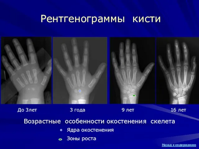 Рентгенограммы кисти Возрастные особенности окостенения скелета До 3лет 3 года 9 лет