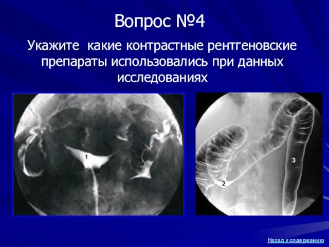 Укажите какие контрастные рентгеновские препараты использовались при данных исследованиях 1 2 3 Вопрос №4