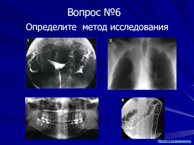 Определите метод исследования 1 2 3 4 Вопрос №6