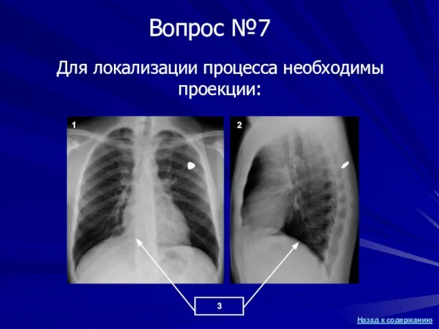 Для локализации процесса необходимы проекции: 1 2 3 Вопрос №7