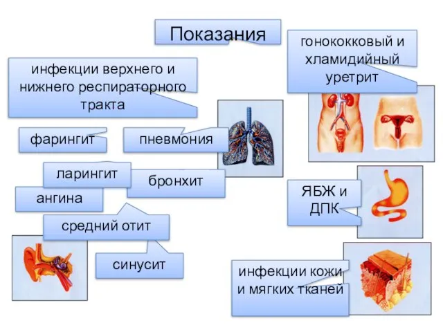 синусит средний отит Показания фарингит бронхит ангина инфекции кожи и мягких тканей