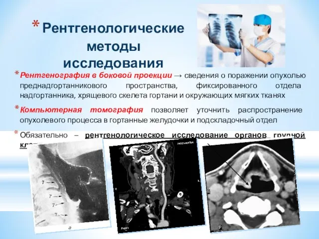 Рентгенологические методы исследования Рентгенография в боковой проекции → сведения о поражении опухолью