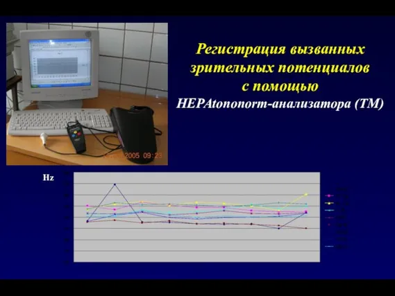 Регистрация вызванных зрительных потенциалов с помощью НЕРАtononorm-анализатора (ТМ) Hz Hz Контроль