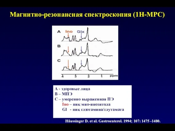 Магнитно-резонансная спектроскопия (1H-МРС) А - здоровые лица В – МПЭ С –