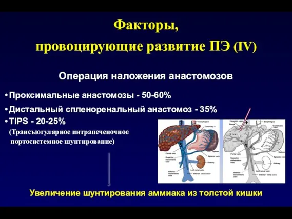 Операция наложения анастомозов Проксимальные анастомозы - 50-60% Дистальный спленоренальный анастомоз - 35%