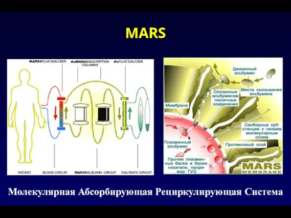 MARS Молекулярная Абсорбирующая Рециркулирующая Система