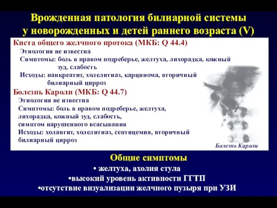 Врожденная патология билиарной системы у новорожденных и детей раннего возраста (V) Киста