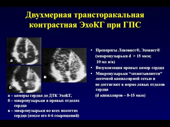 Двухмерная трансторакальная контрастная ЭхоКГ при ГПС Препараты Левовист®, Эховист® (микропузырьки d >