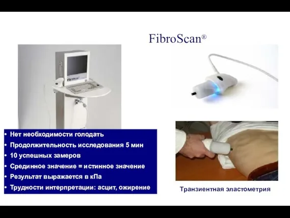 FibroScan® Нет необходимости голодать Продолжительность исследования 5 мин 10 успешных замеров Срединное