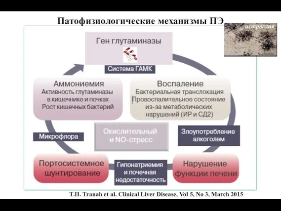 T.H. Tranah et al. Clinical Liver Disease, Vol 5, No 3, March