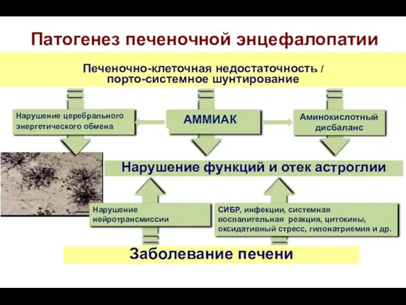 Нарушение церебрального энергетического обмена Аминокислотный дисбаланс Нарушение нейротрансмиссии СИБР, инфекции, системная воспалительная