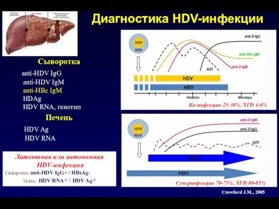 Диагностика HDV-инфекции Сыворотка anti-HDV IgG anti-HDV IgM anti-HBc IgM HDAg HDV RNA,