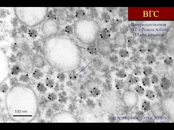 ВГС Иммуноцитохимия ВГС с Protein A-Gold (15 нм) коньюгат 100 nm И.А. Морозов, 2009 г., ИПВЭ