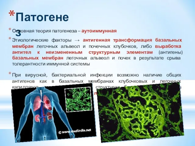 Патогенез Основная теория патогенеза – аутоиммунная Этиологические факторы → антигенная трансформация базальных