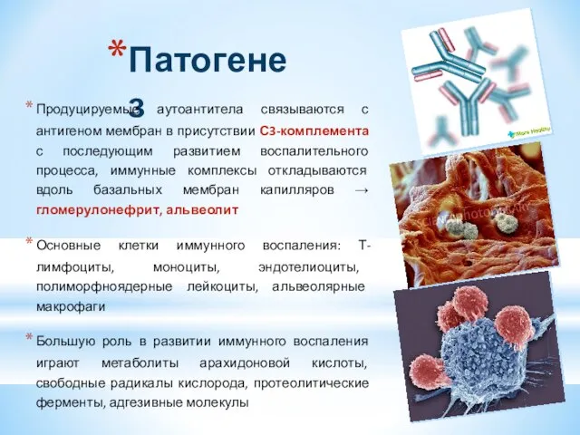 Патогенез Продуцируемые аутоантитела связываются с антигеном мембран в присутствии С3-комплемента с последующим