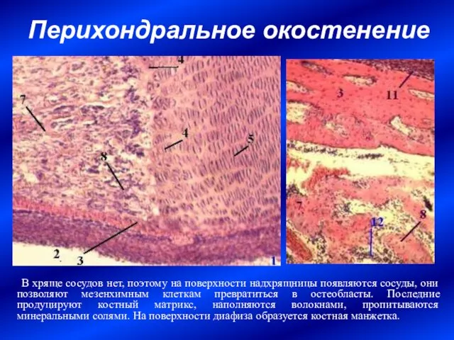 Перихондральное окостенение В хряще сосудов нет, поэтому на поверхности надхрящницы появляются сосуды,