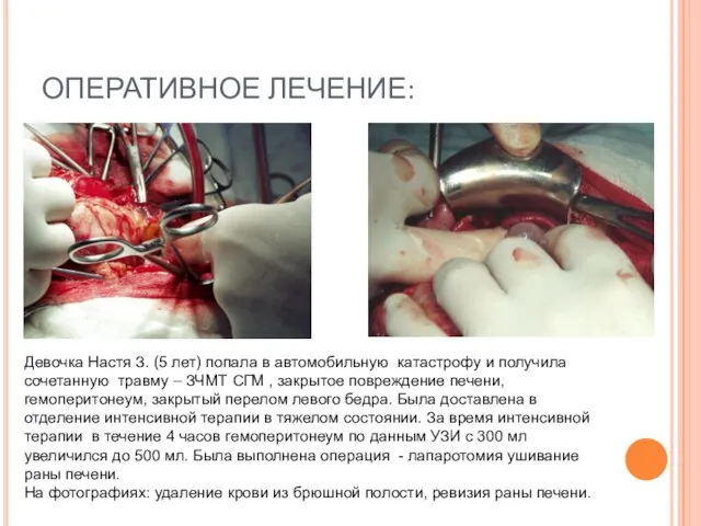 ОПЕРАТИВНОЕ ЛЕЧЕНИЕ: Девочка Настя З. (5 лет) попала в автомобильную катастрофу и