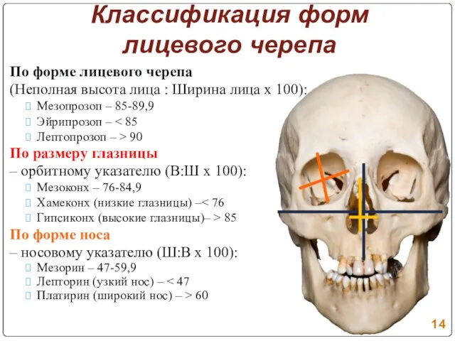 Классификация форм лицевого черепа По форме лицевого черепа (Неполная высота лица :