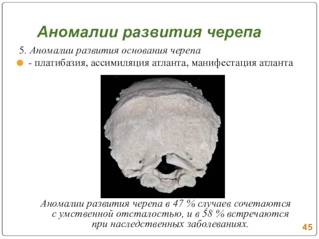 5. Аномалии развития основания черепа - платибазия, ассимиляция атланта, манифестация атланта Аномалии