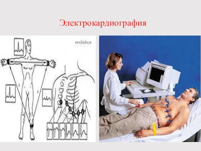 Электрокардиография