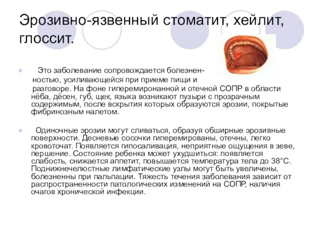 Эрозивно-язвенный стоматит, хейлит, глоссит. Это заболевание сопровождается болезнен- ностью, усиливающейся при приеме