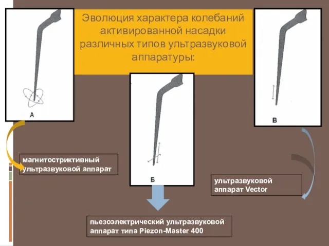 Эволюция характера колебаний активированной насадки различных типов ультразвуковой аппаратуры: магнитостриктивный ультразвуковой аппарат