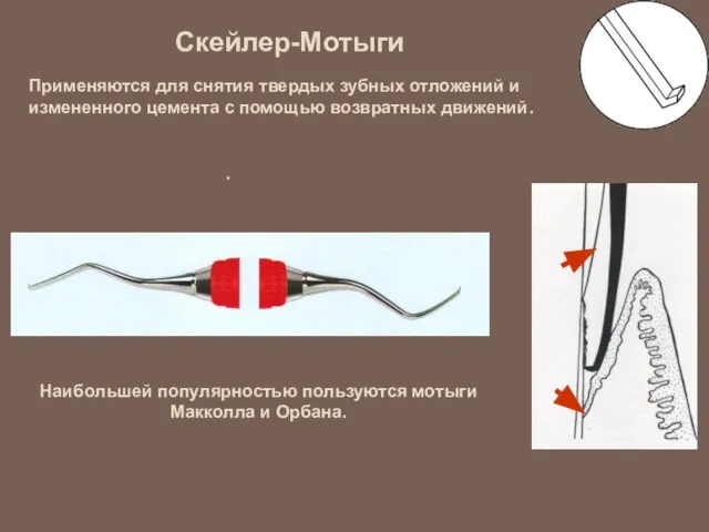 Скейлер-Мотыги Применяются для снятия твердых зубных отложений и измененного цемента с помощью