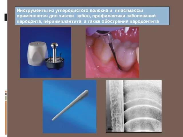 Инструменты из углеродистого волокна и пластмассы применяются для чистки зубов, профилактики заболеваний