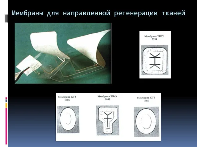 Мембраны для направленной регенерации тканей