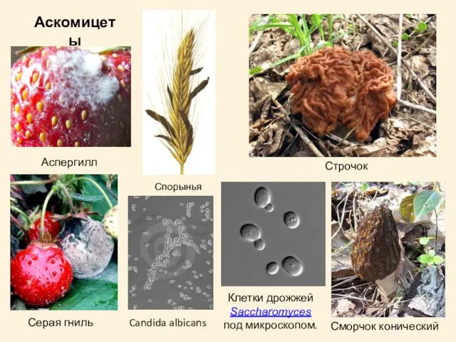 Сморчок конический Строчок Аспергилл Аскомицеты Серая гниль Клетки дрожжей Saccharomyces под микроскопом. Candida albicans Спорынья