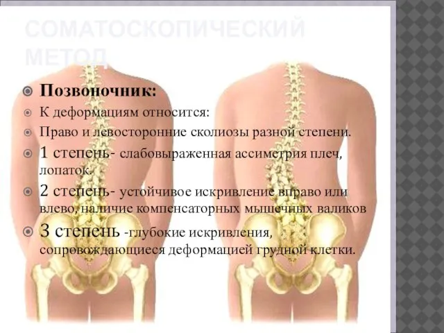 СОМАТОСКОПИЧЕСКИЙ МЕТОД Позвоночник: К деформациям относится: Право и левосторонние сколиозы разной степени.