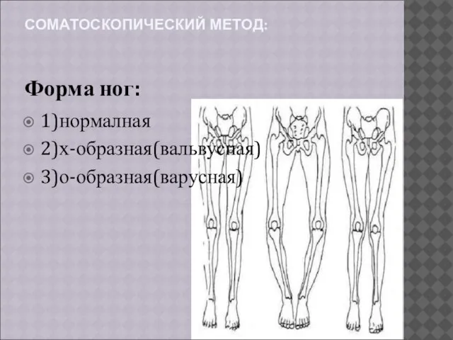 СОМАТОСКОПИЧЕСКИЙ МЕТОД: Форма ног: 1)нормалная 2)х-образная(вальвусная) 3)о-образная(варусная)