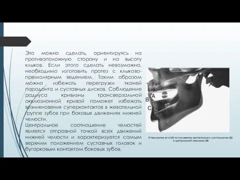 Это можно сделать, ориентируясь на противоположную сторону и на высоту клыков. Если