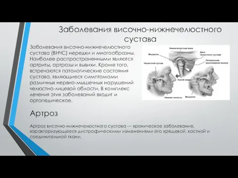 Заболевания височно-нижнечелюстного сустава Заболевания височно-нижнечелюстного сустава (ВНЧС) нередки и многообразны. Наиболее распространенными