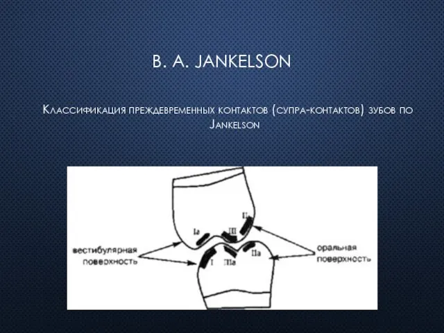 В. A. Jankelson Классификация преждевременных контактов (супра-контактов) зубов по Jankelson