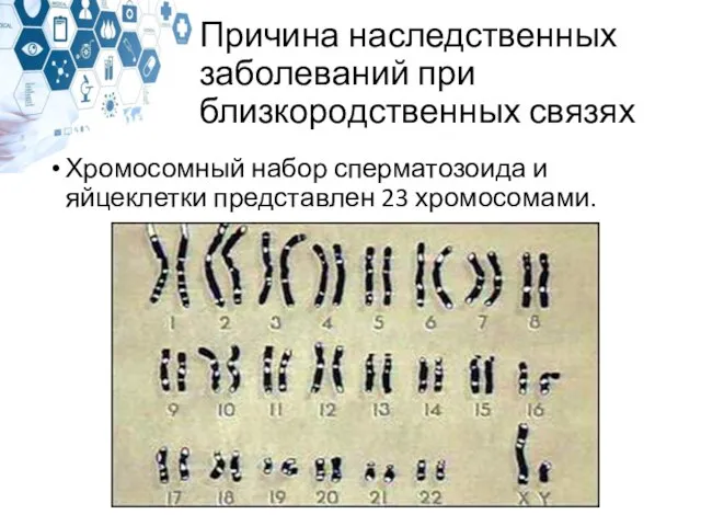 Причина наследственных заболеваний при близкородственных связях Хромосомный набор сперматозоида и яйцеклетки представлен 23 хромосомами.