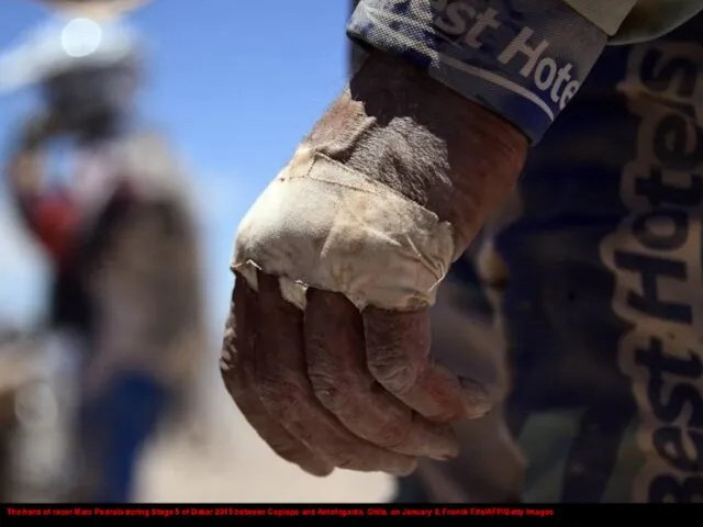 The hand of racer Marc Pedrola during Stage 5 of Dakar 2015