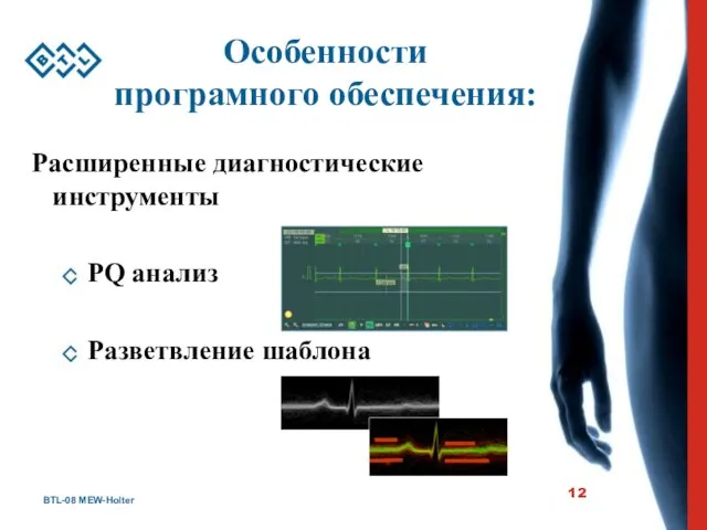 BTL-08 MEW-Holter Особенности програмного обеспечения: Расширенные диагностические инструменты PQ анализ Разветвление шаблона